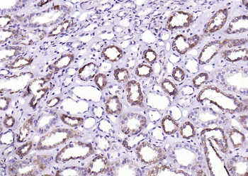 BMPR1A Rabbit Polyclonal Antibody