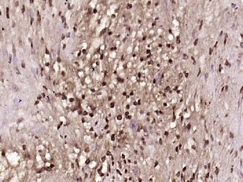 BRCA1 Rabbit Polyclonal Antibody