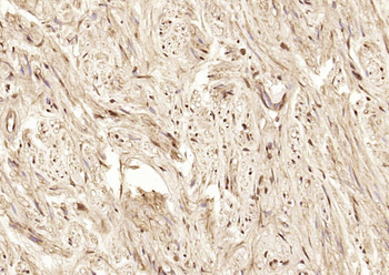 BRCA1 Rabbit Polyclonal Antibody