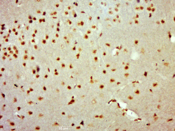 BRCA1 Rabbit Polyclonal Antibody