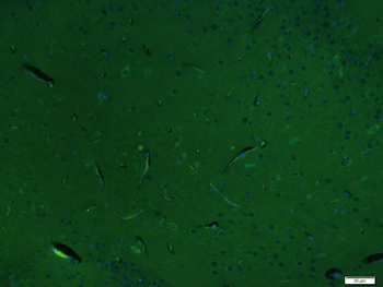 PAK3 Rabbit Polyclonal Antibody