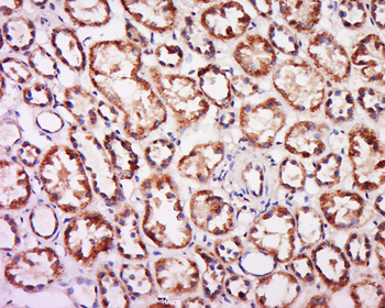 PAK3 Rabbit Polyclonal Antibody