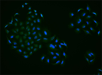 BRMS1 Rabbit Polyclonal Antibody