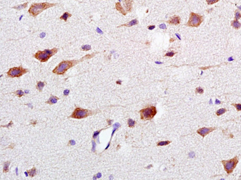 CAMK2A + CAMK2B + CAMK2D Rabbit Polyclonal Antibody