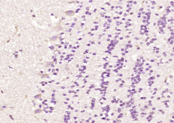 CTNNAL1 Rabbit Polyclonal Antibody