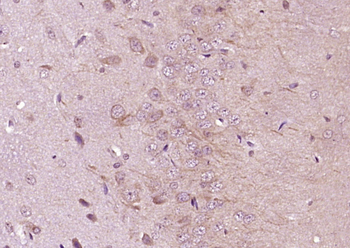 CTNNA1 Rabbit Polyclonal Antibody