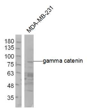 Gamma catenin Rabbit Polyclonal Antibody