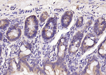 Ceramide glucosyltransferase Rabbit Polyclonal Antibody