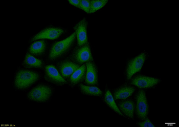 CCR7 Rabbit Polyclonal Antibody