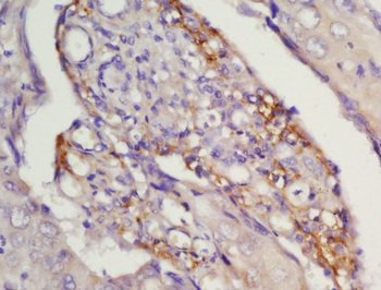 CCR7 Rabbit Polyclonal Antibody
