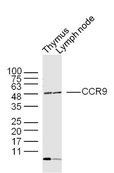 CCR9 Rabbit Polyclonal Antibody