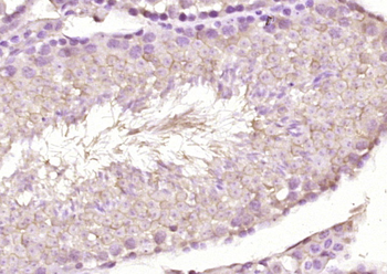 CCR10 Rabbit Polyclonal Antibody