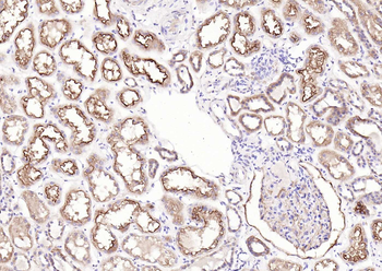 CD10 Rabbit Polyclonal Antibody