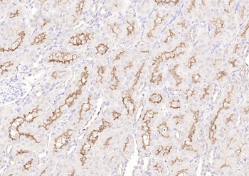 CD10 Rabbit Polyclonal Antibody