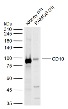 CD10 Rabbit Polyclonal Antibody