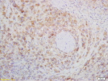 CD272 Rabbit Polyclonal Antibody