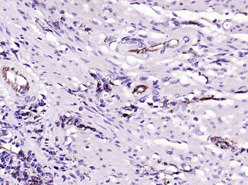 CD31 Rabbit Polyclonal Antibody