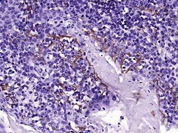 CD31 Rabbit Polyclonal Antibody