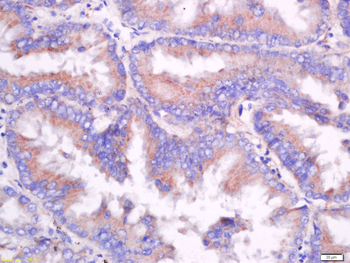 CD55 Rabbit Polyclonal Antibody