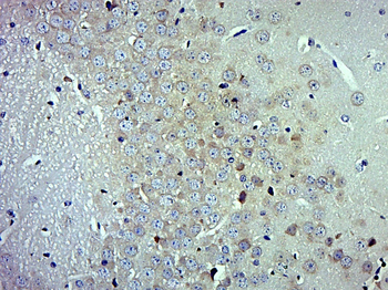 CD56 Rabbit Polyclonal Antibody