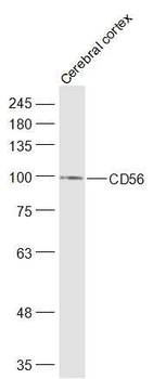CD56 Rabbit Polyclonal Antibody
