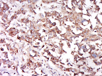 CD68 Rabbit Polyclonal Antibody