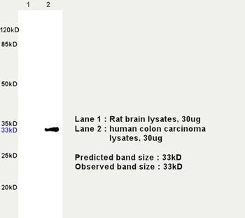 CDK4 Rabbit Polyclonal Antibody