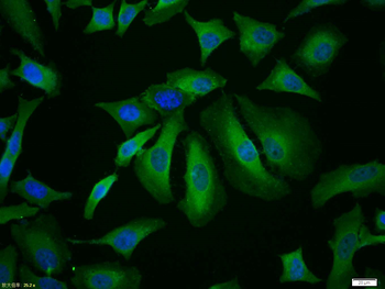 CDK4 Rabbit Polyclonal Antibody