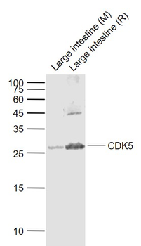 CDK5 Rabbit Polyclonal Antibody