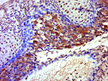 CDK5 Rabbit Polyclonal Antibody