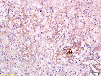 CHI3L1 Rabbit Polyclonal Antibody