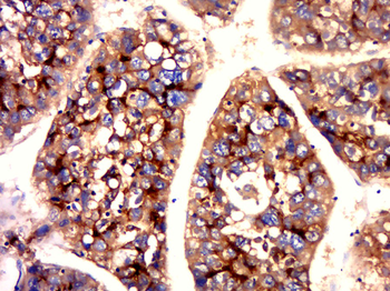 CEA (B5) Mouse Monoclonal Antibody