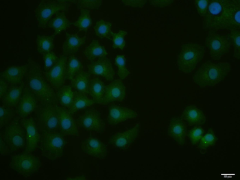 CEBP-alpha Rabbit Polyclonal Antibody