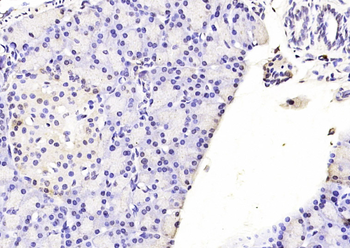 CEBP-alpha Rabbit Polyclonal Antibody