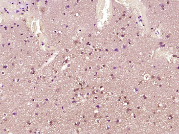 CEBP Beta Rabbit Polyclonal Antibody