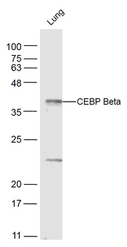 CEBP Beta Rabbit Polyclonal Antibody