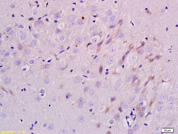 ERBB3 Rabbit Polyclonal Antibody