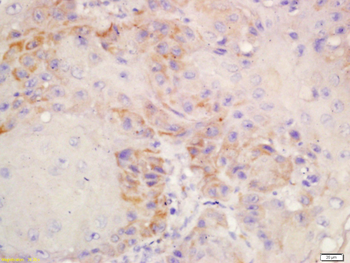 ERBB3 Rabbit Polyclonal Antibody
