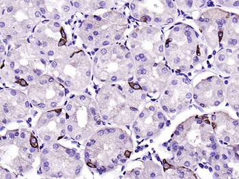 CHGA Rabbit Polyclonal Antibody