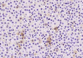CHGA Rabbit Polyclonal Antibody