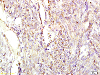 CHGA Rabbit Polyclonal Antibody
