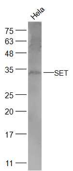 SET Rabbit Polyclonal Antibody