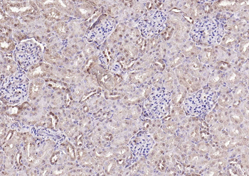 Proteasome 20S alpha 1 Rabbit Polyclonal Antibody