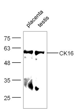 CK16 Rabbit Polyclonal Antibody