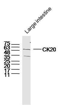 CK20 Rabbit Polyclonal Antibody