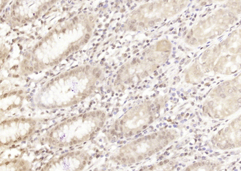 Cytokeratin 4 Rabbit Polyclonal Antibody
