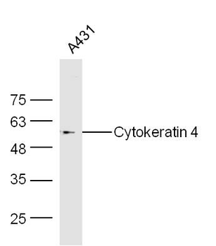 Cytokeratin 4 Rabbit Polyclonal Antibody