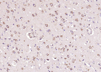 APG4B (Acetyl K39) Rabbit Polyclonal Antibody