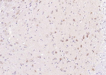 APG4B (Acetyl K39) Rabbit Polyclonal Antibody