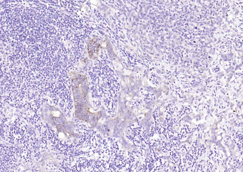 TGF beta Receptor I Mouse Monoclonal Antibody